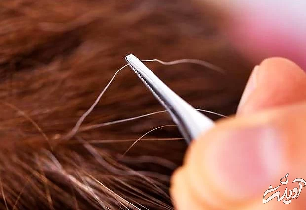 آیا کندن موی سفید باعث زیاد شدن میشود اشتباهات سفیدی مو